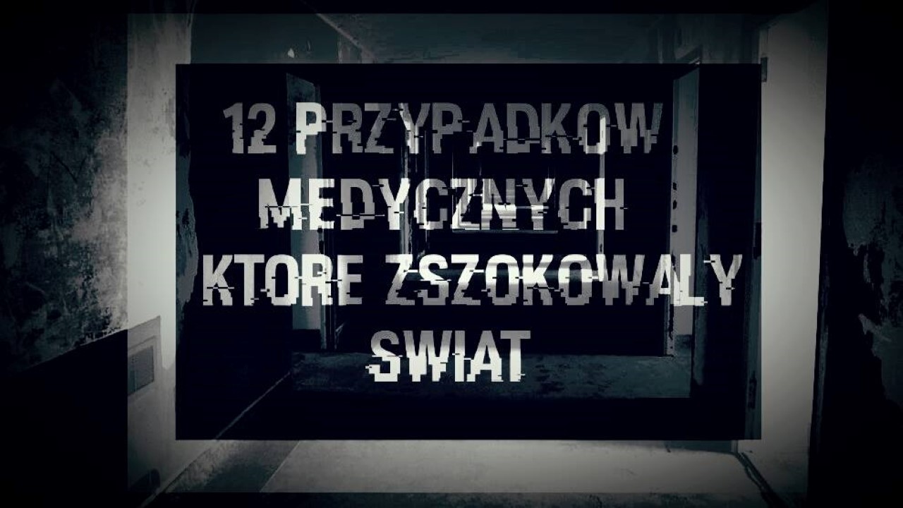 12 Przypadków medycznych, które zszokowały świat [Lektor PL]